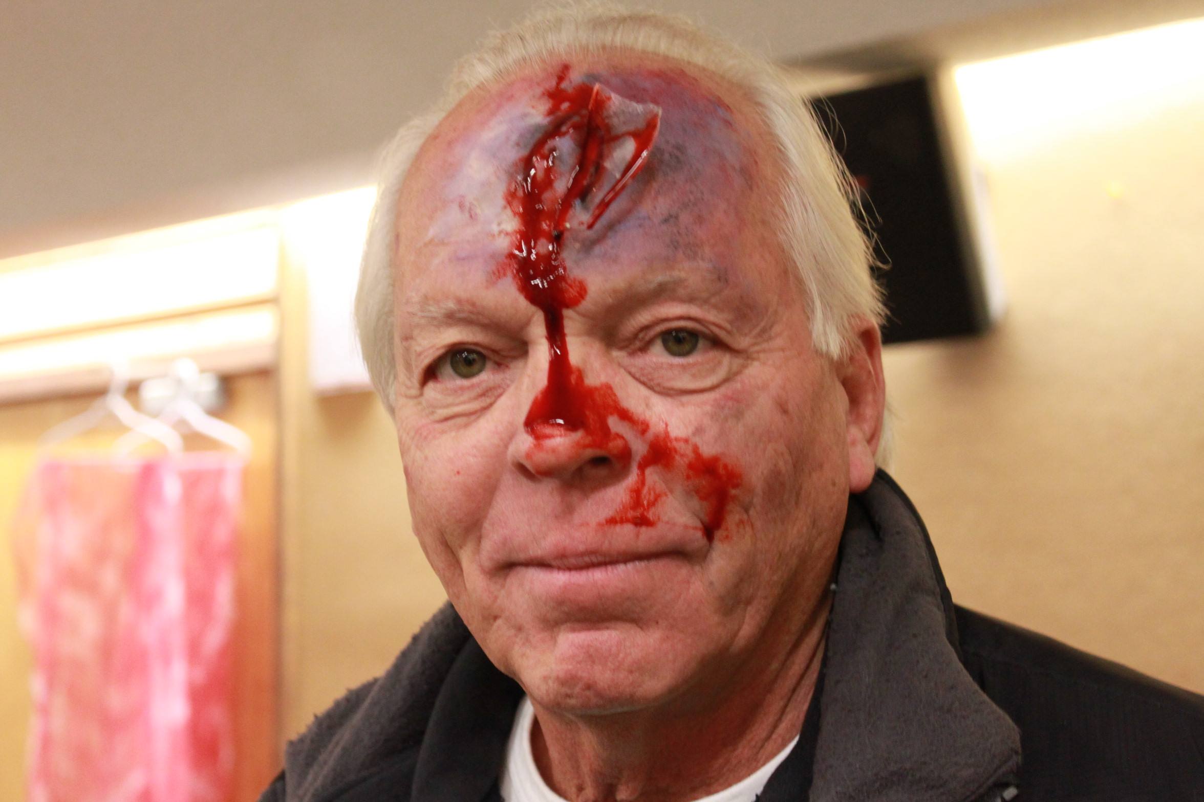Red Cross volunteer Tim Steele. Don't worry! It's not real - it's just make-up, but it looks real! Volunteers act as casualties. 