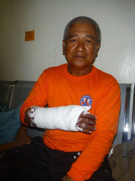 Rogelio Arges of Ormoc received treatment from the Red Cross field hospital staff for a broken arm the day before the hospital actually opened.