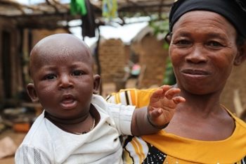 In Mali, most infant deaths are associated with diseases that can be treated with medication.